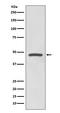Cyclin E1 antibody, M00543, Boster Biological Technology, Western Blot image 