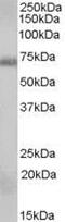 RAD9 Checkpoint Clamp Component A antibody, PA5-18624, Invitrogen Antibodies, Western Blot image 