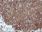 Mitogen-Activated Protein Kinase Kinase 1 antibody, LS-C174496, Lifespan Biosciences, Immunohistochemistry frozen image 