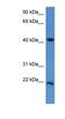 Inner Mitochondrial Membrane Peptidase Subunit 2 antibody, NBP1-79839, Novus Biologicals, Western Blot image 