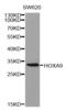HOXA9 antibody, LS-C331761, Lifespan Biosciences, Western Blot image 