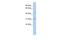 SIX Homeobox 1 antibody, PA5-40532, Invitrogen Antibodies, Western Blot image 