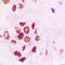 Protein Inhibitor Of Activated STAT 3 antibody, LS-C353250, Lifespan Biosciences, Immunohistochemistry frozen image 