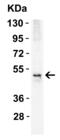 TNF Receptor Superfamily Member 10b antibody, 2421, QED Bioscience, Western Blot image 