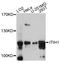 Inter-Alpha-Trypsin Inhibitor Heavy Chain 1 antibody, abx126018, Abbexa, Western Blot image 