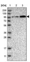MINDY Lysine 48 Deubiquitinase 4 antibody, NBP1-91238, Novus Biologicals, Western Blot image 