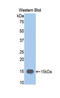 Matrix Metallopeptidase 12 antibody, LS-C295309, Lifespan Biosciences, Western Blot image 