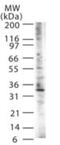 Nucleolar Protein Interacting With The FHA Domain Of MKI67 antibody, GTX13913, GeneTex, Western Blot image 