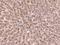 Charged Multivesicular Body Protein 2A antibody, 200839-T08, Sino Biological, Immunohistochemistry paraffin image 