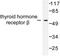 Thyroid Hormone Receptor Beta antibody, AP06354PU-N, Origene, Western Blot image 