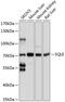 Squalene Epoxidase antibody, GTX65578, GeneTex, Western Blot image 