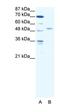 Interferon Regulatory Factor 5 antibody, orb329962, Biorbyt, Western Blot image 