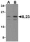 Interleukin 23 Subunit Alpha antibody, AHP1174, Bio-Rad (formerly AbD Serotec) , Western Blot image 