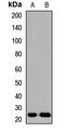 Gastrin cell antibody, orb412542, Biorbyt, Western Blot image 