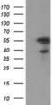 Katanin Catalytic Subunit A1 Like 1 antibody, MA5-25453, Invitrogen Antibodies, Western Blot image 
