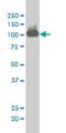 Chromosome Segregation 1 Like antibody, H00001434-M03, Novus Biologicals, Western Blot image 