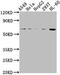MDM2 Proto-Oncogene antibody, CSB-PA11628A0Rb, Cusabio, Western Blot image 