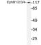 EPH Receptor B1 antibody, LS-C177776, Lifespan Biosciences, Western Blot image 