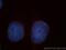 BMI1 Proto-Oncogene, Polycomb Ring Finger antibody, 10832-1-AP, Proteintech Group, Immunofluorescence image 