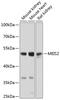 Meis Homeobox 2 antibody, GTX64612, GeneTex, Western Blot image 