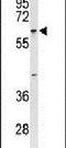 Trichoplein Keratin Filament Binding antibody, PA5-26363, Invitrogen Antibodies, Western Blot image 