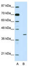 Homeobox Containing 1 antibody, TA345388, Origene, Western Blot image 