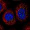 Zinc Finger Protein 296 antibody, NBP2-13565, Novus Biologicals, Immunocytochemistry image 