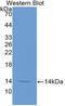 Melatonin Receptor 1A antibody, LS-C314297, Lifespan Biosciences, Western Blot image 