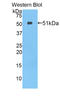 Protein-lysine 6-oxidase antibody, LS-C304459, Lifespan Biosciences, Western Blot image 