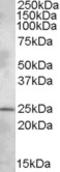 Pleckstrin Homology Domain Containing B1 antibody, STJ71767, St John