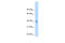 Nuclear Receptor Subfamily 2 Group F Member 2 antibody, 29-062, ProSci, Immunohistochemistry frozen image 