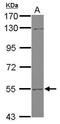 UDP Glucuronosyltransferase Family 2 Member B7 antibody, GTX114203, GeneTex, Western Blot image 