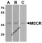 Mitochondrial Trans-2-Enoyl-CoA Reductase antibody, 7151, ProSci, Western Blot image 