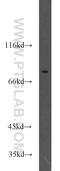 Transmembrane Protein 181 antibody, 55411-1-AP, Proteintech Group, Western Blot image 