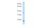 Growth Hormone 2 antibody, A03890, Boster Biological Technology, Western Blot image 