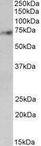 Microtubule-associated serine/threonine-protein kinase 3 antibody, 43-407, ProSci, Western Blot image 