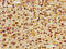 Integrin Subunit Alpha V antibody, CSB-PA011877LA01HU, Cusabio, Immunohistochemistry paraffin image 