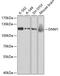 Dynamin 1 antibody, A2902, ABclonal Technology, Western Blot image 