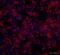 Neurofilament Light antibody, ab72997, Abcam, Immunocytochemistry image 