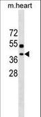 ER Membrane Protein Complex Subunit 2 antibody, LS-C157292, Lifespan Biosciences, Western Blot image 