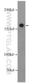 Formin 1 antibody, 25982-1-AP, Proteintech Group, Western Blot image 