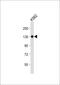 Integrin Subunit Alpha 8 antibody, A06636-1, Boster Biological Technology, Western Blot image 