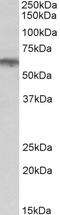 Adrenoceptor Alpha 1B antibody, LS-C186438, Lifespan Biosciences, Western Blot image 