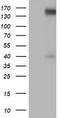 ERBB2 antibody, TA503525S, Origene, Western Blot image 
