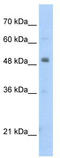 PBX Homeobox 3 antibody, TA329893, Origene, Western Blot image 