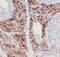 Phosphatidylinositol Glycan Anchor Biosynthesis Class K antibody, FNab06441, FineTest, Immunohistochemistry frozen image 