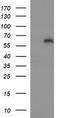 Interleukin 10 Receptor Subunit Alpha antibody, M03597, Boster Biological Technology, Western Blot image 