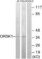 Olfactory Receptor Family 5 Subfamily K Member 1 antibody, LS-C120893, Lifespan Biosciences, Western Blot image 