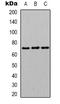 Heterogeneous Nuclear Ribonucleoprotein L antibody, orb338889, Biorbyt, Western Blot image 