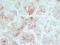 Keratin 5 antibody, LS-B16140, Lifespan Biosciences, Immunohistochemistry frozen image 